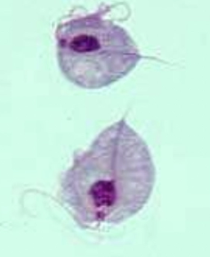 <p><u>Agent:</u> <em>Trichomonas foetus</em> = Flagellate protozoan with 3 forward-facing flagella and 1 posterior</p><ul><li><p>Reproduce via binary fission</p></li></ul><p><u>Prevalence:</u> Uncommon in NZ, but historical outbreak on East Coast</p><p><u>Source:</u> Bull genital tract (no disease but infected for life) → Cull</p><p><u>Transmission:</u> Naive cow infected by bull during coitus (esp. heifer)</p><ul><li><p><em>T. foetus</em> multiplies in vagina causing vaginitis</p></li><li><p>Travels through cervix to uterus and destroys the placenta</p></li></ul><p><u>Clinical Sign:</u> Abortion 6 - 8w after natural mating → Late return to service</p><p><u>Diagnosis:</u></p><ol><li><p>Flush prepuce with saline or growth media for PCR (also foetus and vaginal discharge)</p></li><li><p>Ab detected in vaginal.cervical mucus</p></li></ol><p><u>Treatment:</u> Cows spontaneously clear infection</p>