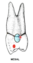 <p>- in the middle portion of the cervical third of the crown</p>
