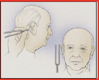 <ul><li><p>comparison of air and bone conduction in one ear</p></li><li><p>tuning fork on mastoid process of ear and in front of ear- ask where the sound is the loudest</p></li></ul><p></p>