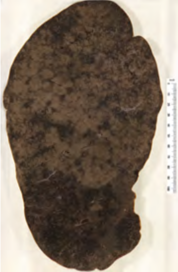 <p>Identify the POT</p>