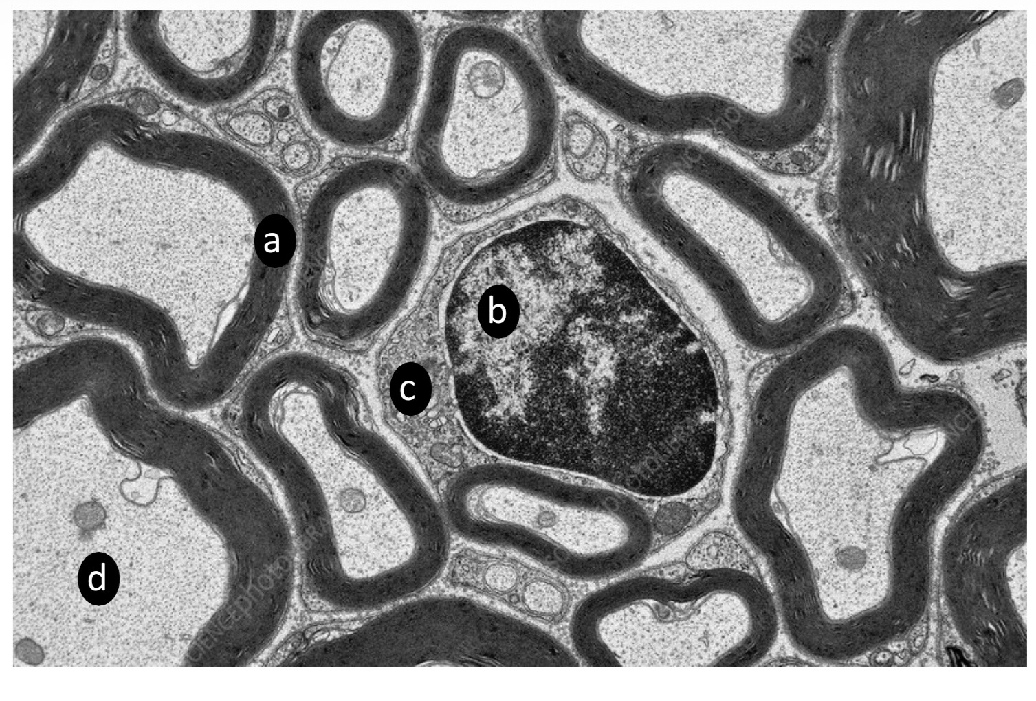 <p>ID the labeled structures: A-C</p><p>D. Name two structures present at the labeled region. </p>