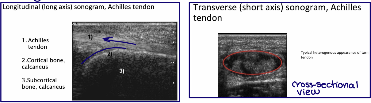 <p>In short axis and long axis relative to the structure examined</p>