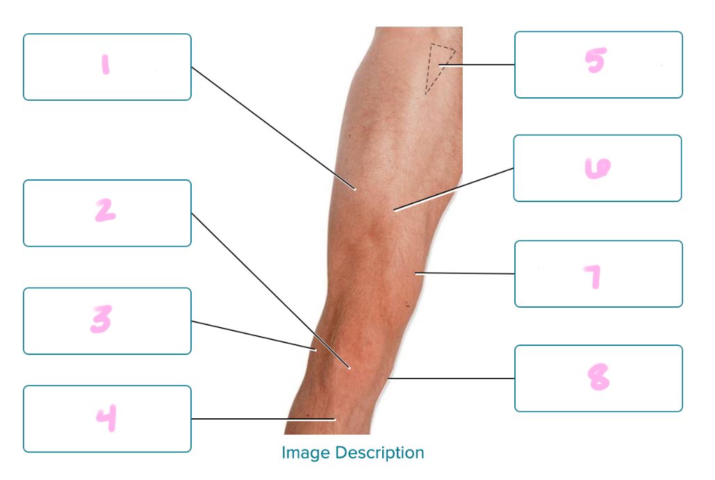 <p>Label the structures in an anterior view of the right thigh.</p><ul><li><p>Lateral epicondyle of femur </p></li><li><p>Vastus lateralis </p></li><li><p>Medial epicondyle of femur </p></li><li><p>Femoral triangle </p></li><li><p>Rectus femoris </p></li><li><p>Patella </p></li><li><p>Tibial tuberosity </p></li><li><p>Vastus medialis </p></li></ul><p></p>
