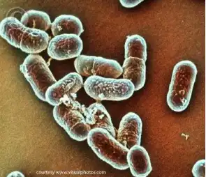 <p>Listeria monocytogenes Pathogenesis</p>