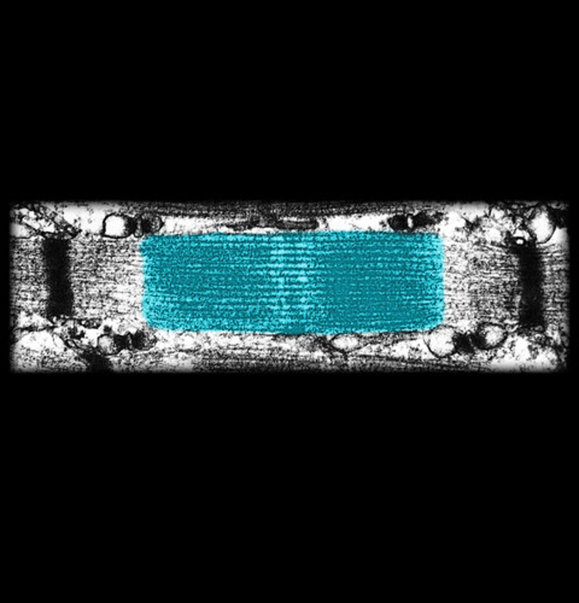 <p>Dark region where thick and thin filaments overlap.</p>