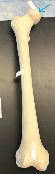 <p>ID femur region </p>