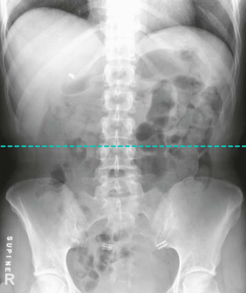 <p>KUB: Is this Image Good?</p>