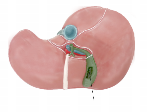 <p><span>Name the structure</span></p>