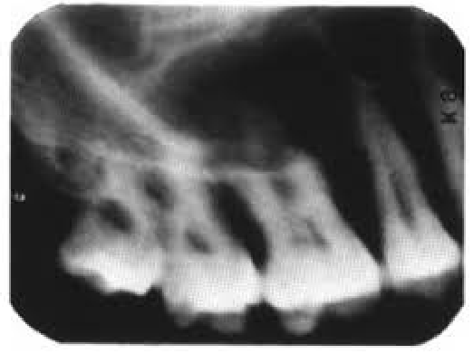 <p>Blurred Image</p>