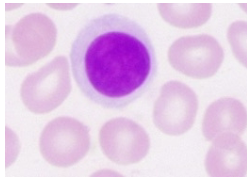 <p>Key Cells of the immune system: Lymphocytes and plasma cells</p>