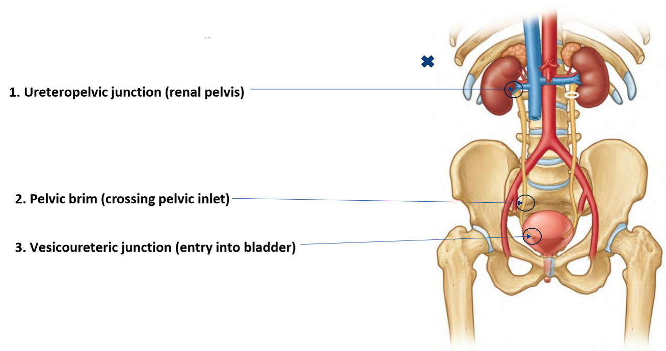 <ol><li><p><strong>Ureteropelvic junction</strong>: renal pelvis:</p><ul><li><p>wide renal pelvis → narrow true ureter</p></li><li><p>‘loin-to-groin’ pain; common symptom of kidney stones</p></li></ul></li><li><p><strong>Pelvic brim</strong>: crossing pelvic inlet</p><ul><li><p>Where the ureter bends as it crosses over the pelvic brim</p></li></ul></li><li><p><strong>Vesicoureteric junction</strong>: posterior entry into bladder</p></li></ol><p></p>