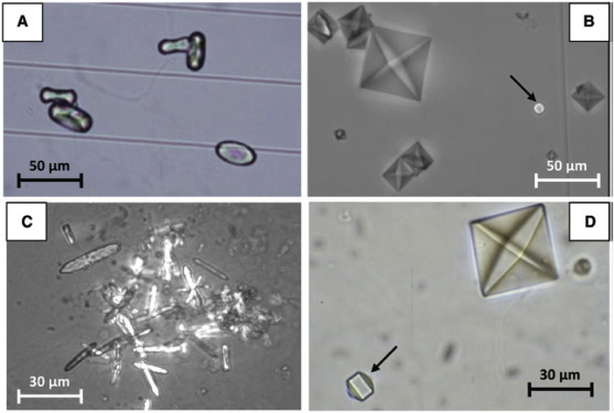 <p>Calcium oxalate in acidic urine, but can be seen in alkaline urine.</p><p>Dihydrate (normal) and monohydrate (dumbell)</p>