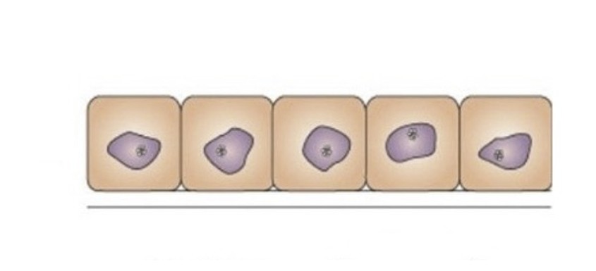 <p>Which cellular adaptation is this:</p><ul><li><p>Increase in the size of cells, resulting in an enlarged tissue mass</p></li></ul><p></p>