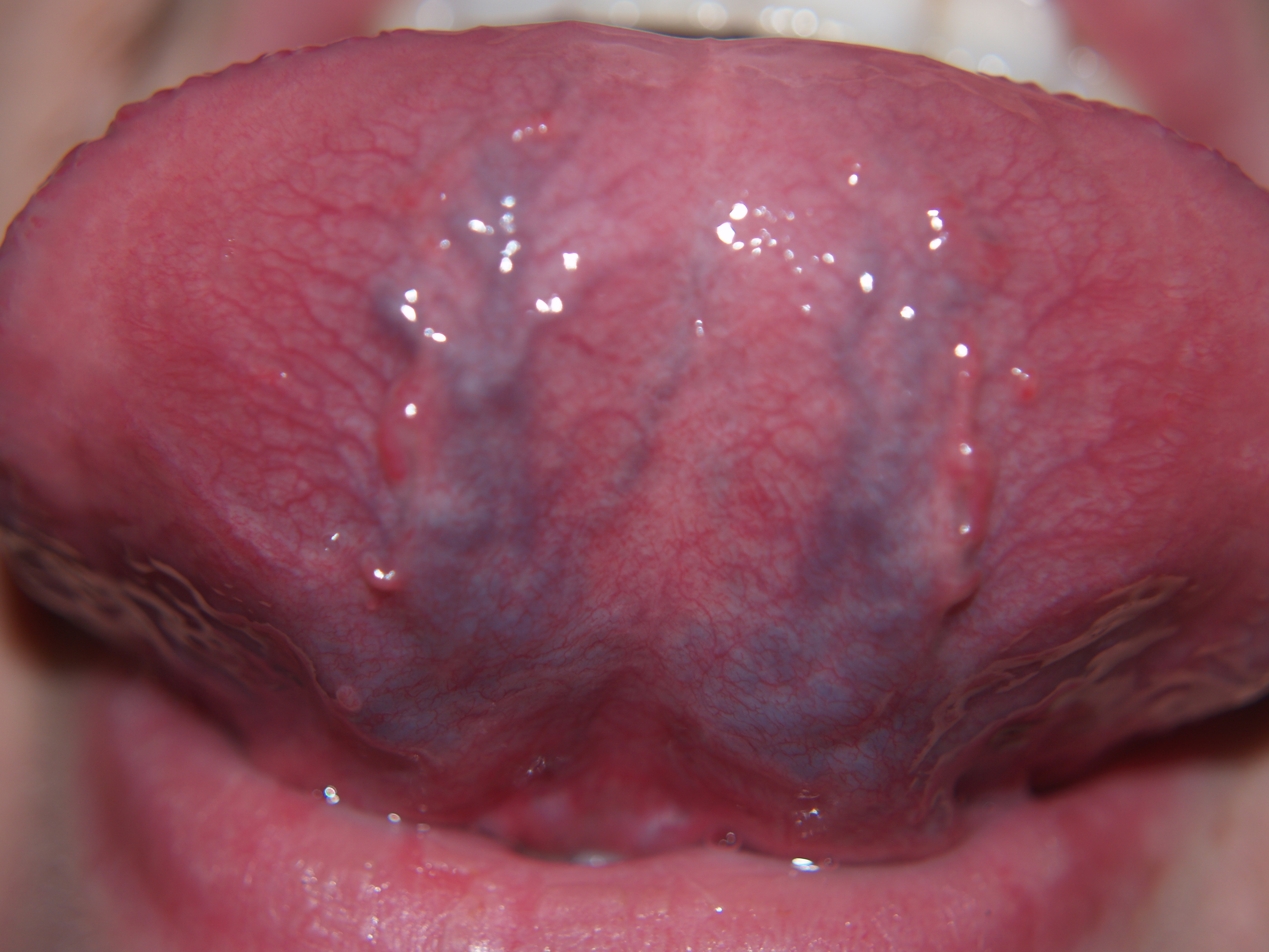 <p>What is this lesion?</p>