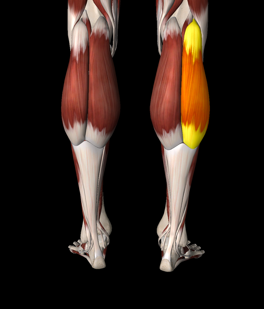 <p>What muscle is this?</p>