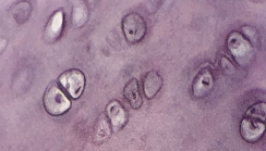 <p>Tipo de tejido cartilaginoso</p>