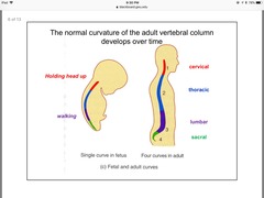 <p>one curvature, concave anteriorly (convex posteriorly) = PRIMARY CURVATURE 1°</p><p>---> curvature is a result of differences in the height between the anterior and the posterior aspects of the *vertebral bodies*.</p>