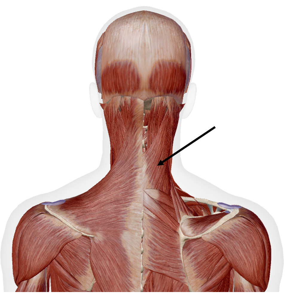 <p>Identify the name of the muscle that the arrow is pointing to in the image.</p>