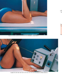 <p>SID: 40in</p><p>kVp: 70-80</p><p>Grid: No grid</p><p>CR: Directed inferosuperiorly at 15-20˚ from lower legs (start at horizontal) to be tangential to patellofemoral joint</p><p>Patient position: prone or seated position, Flex knee to a minimum of 90˚ (Have patient hold onto gauze or tape for prone)</p><p>Evaluation criteria: intercondylar sulcus (trochlear groove) and patella of each distal femur should be visualized, patellofemoral joint space open</p>
