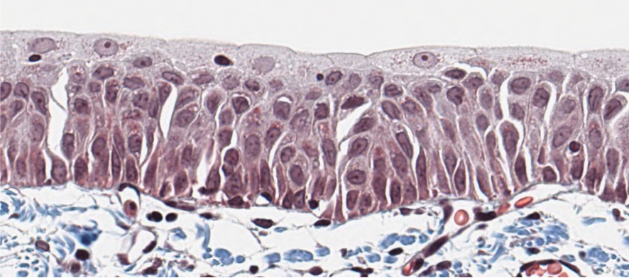 <p><span style="font-family: "Calibri Light";">Is this transitional epithelium classified as pseudostratified or pseudostratified columnar? <br></span></p>
