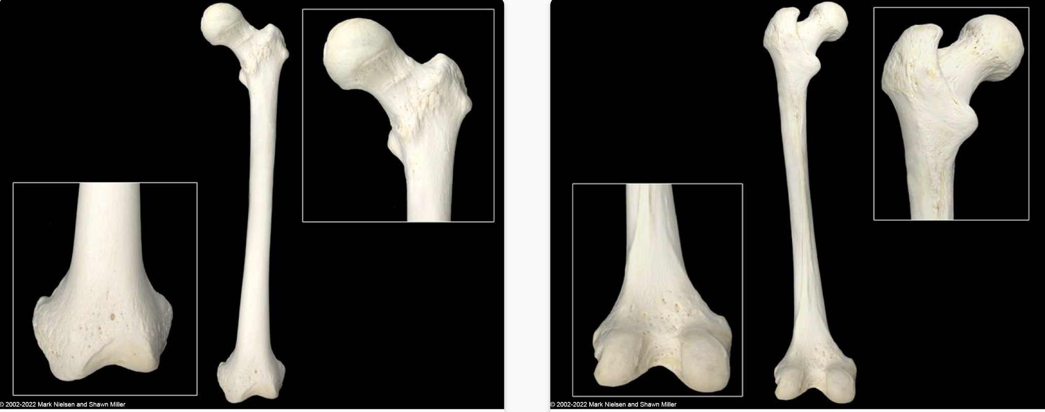 <p>thigh bone</p>