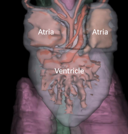 <p>3 chambered where both atria dump blood into the one ventricle </p>