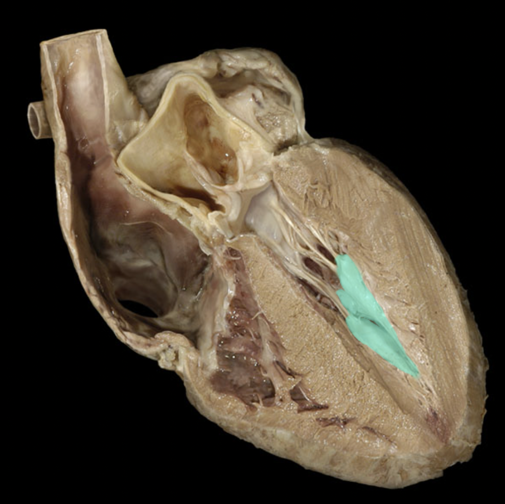 <p>Identify the feature of the right ventricle</p>