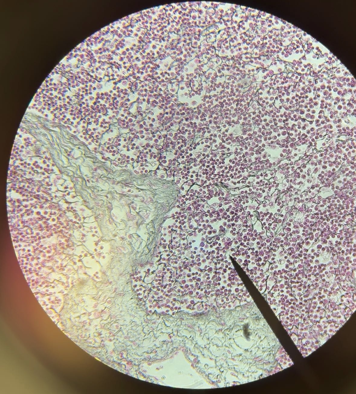 <p>tissue</p>