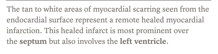 <p><span><strong>Cardiopatía isquémica crónica </strong></span></p>