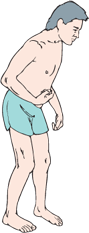 <p>What can cause this gait pattern?</p>