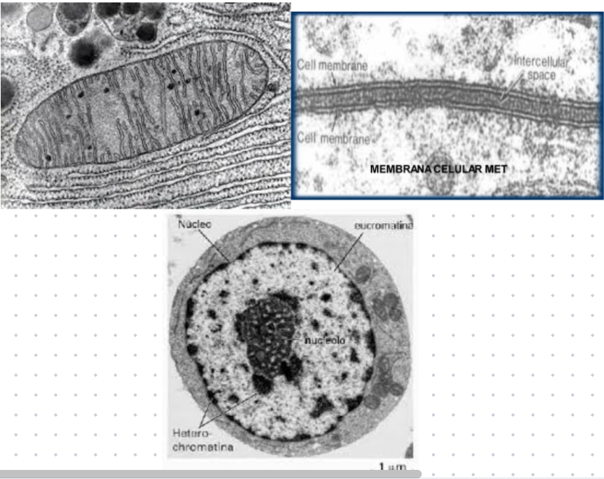 <p><strong>Mitocondria, Membrana citoplasmática y Núcleo</strong></p>