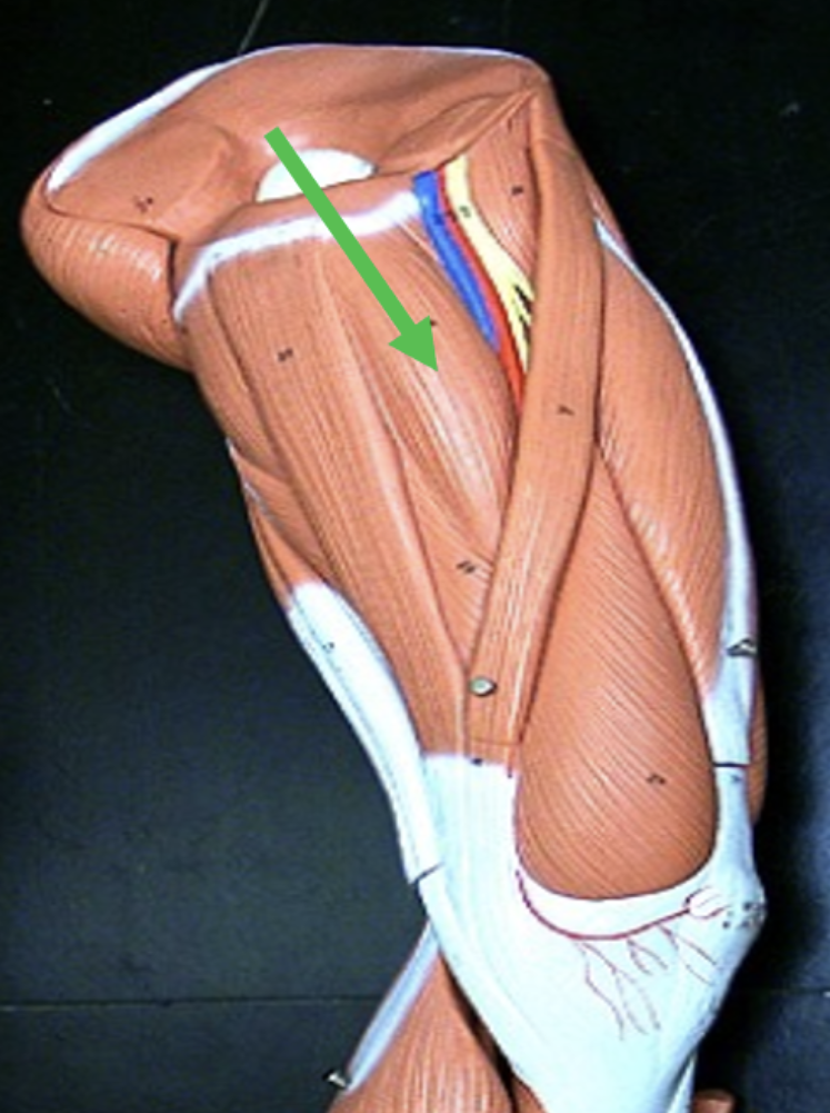 <p>Identify the muscle indicated by the pointer.</p>