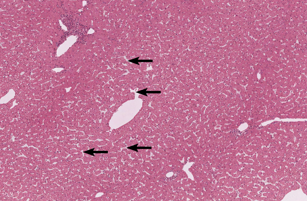 <p>Liver</p><p><strong>NOTICE: THE TIGHTLY PACKED HEPATOCYTES FORMING THE UNIQUE HEXAGONAL SHAPE OF THE LOBULES AND THE LIVER SINUSOIDS THAT SUPPLY THEM WITH NUTRIENTS</strong></p>