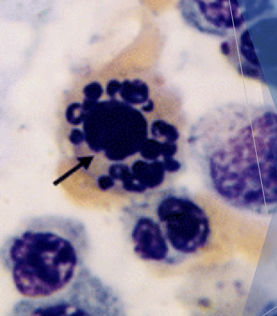 <p>Rupture of nucleus in neutrophils</p><ul><li><p>weakly toxic environment </p></li></ul><p></p>