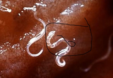 <p>what worm</p>