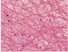 <p>Identify the type of connective tissue</p>