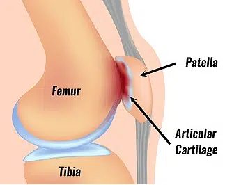 <p>What injury / condition? </p>