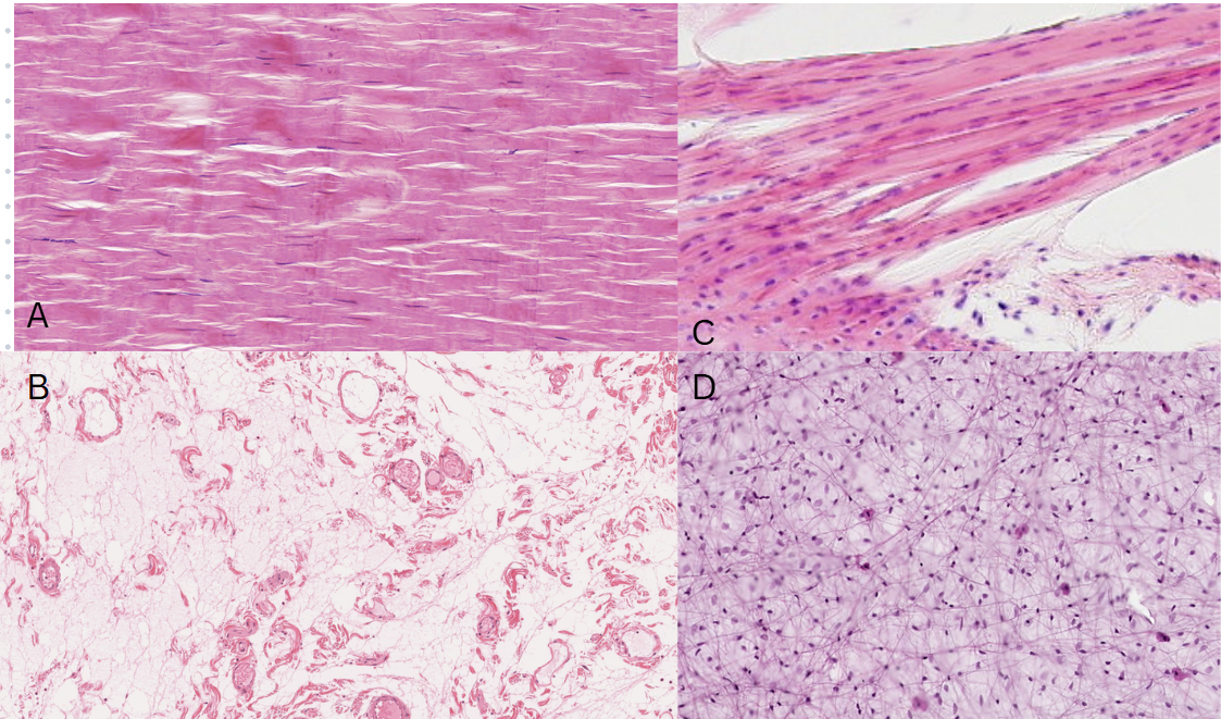 <p>Los diferentes tipos de tejido conectivo difieren en cuanto a la densidad de las células, fibras y componentes de matriz extracelular (MEC). De acuerdo a la imagen, ¿cuáles son los que <strong>resisten a la capacidad de tensión</strong>? </p>