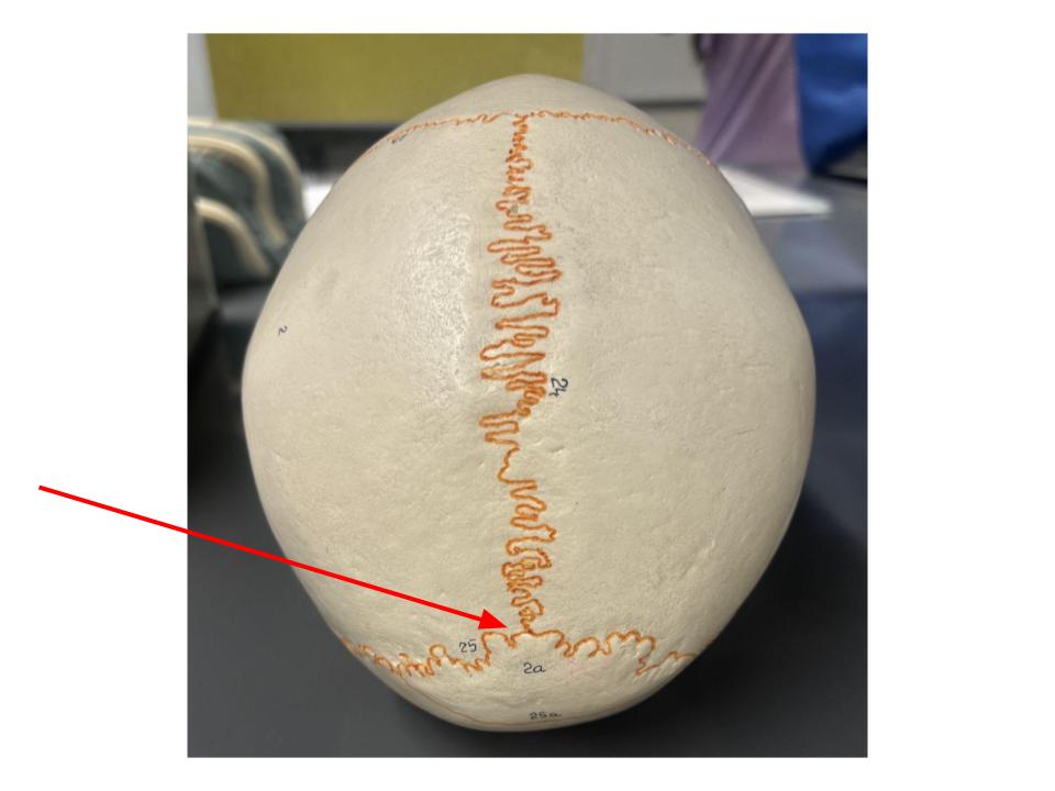 <p>between occipital and parietal bones</p>