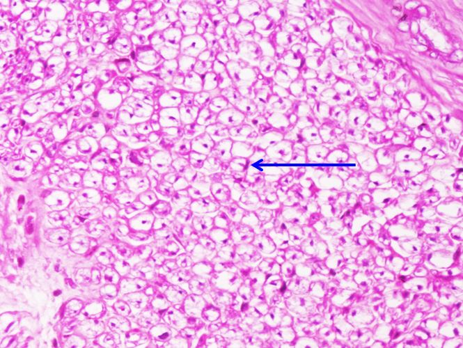 <p>Tế bào gì ?</p>