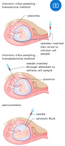 <p>Performing genetic tests on an embryo to show if they carry a specific allele.</p>