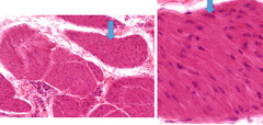 <p>Identify the tissue?</p>