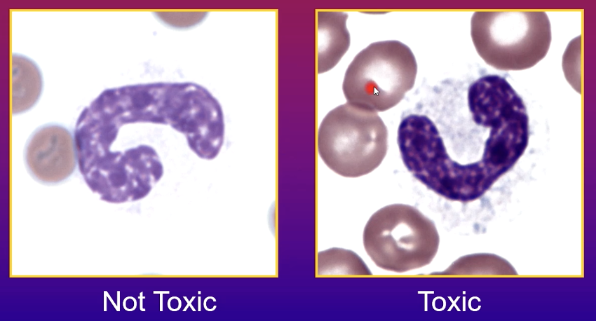 <p>Basophilic, foamy cytoplasm </p>