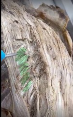 <p>Name the muscle</p><p>- just lateral to rotators (longus and brevis)</p>