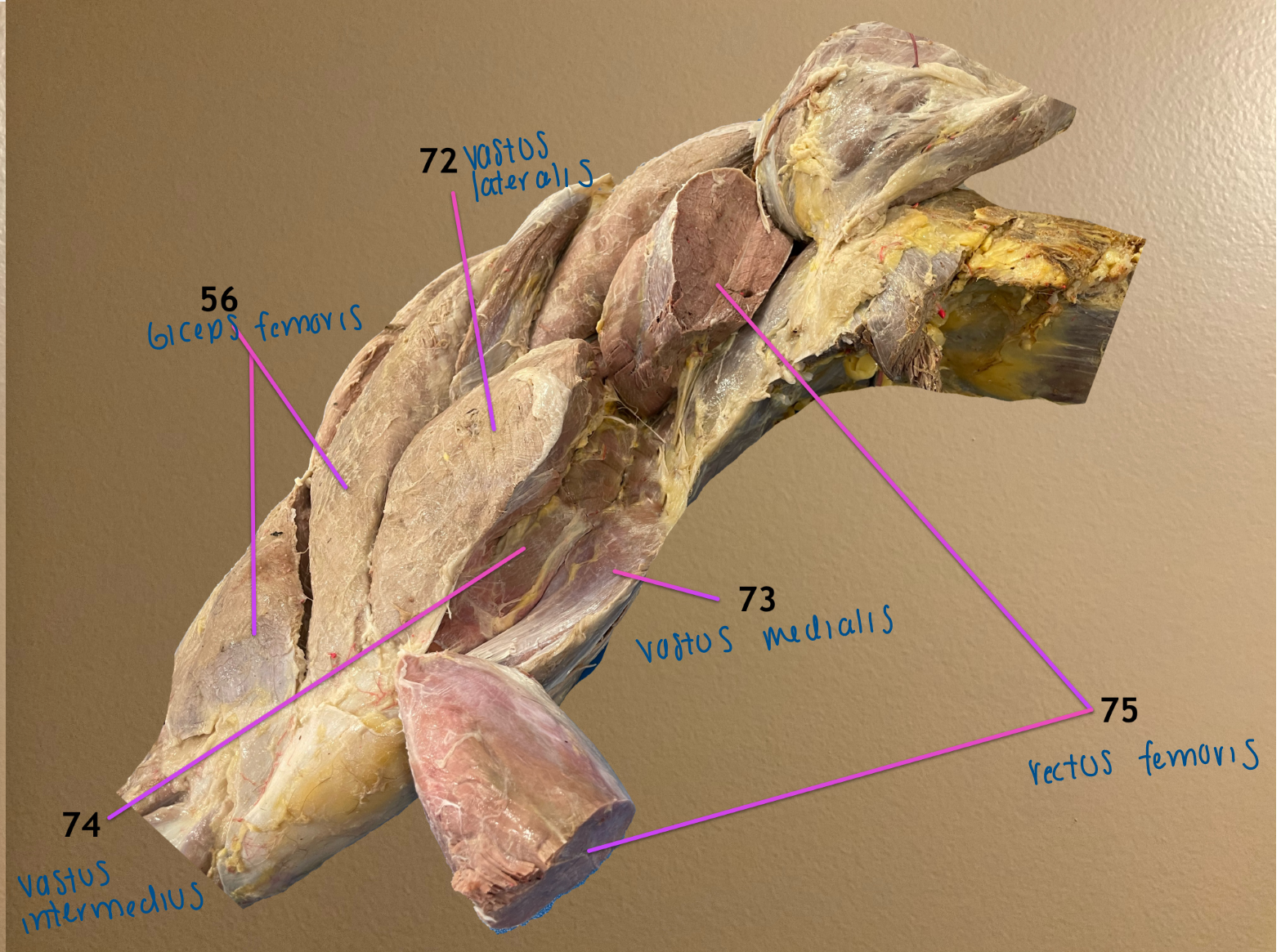 <ol start="72"><li><p>vastus lateralis </p></li><li><p>vastus medialis</p></li><li><p>vastus intermedius</p></li></ol><p>.</p><p><em>note: all are stifle extensors; rectus femoris (75) is also part of quad fem</em></p>