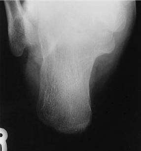 <p><strong>What is in profile on this image?</strong></p>