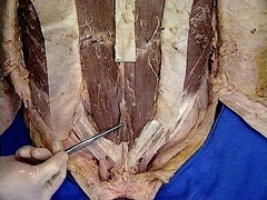 <p>Identify the structure</p>