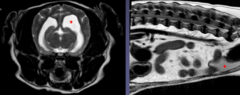 <p>fluid is hyperintense (WHITE)</p><p>Fat is hyperintense (WHITE)</p>