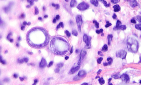 <p>What organism is this slide showing?</p>