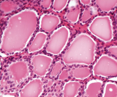 <p>thyroid follicles</p>